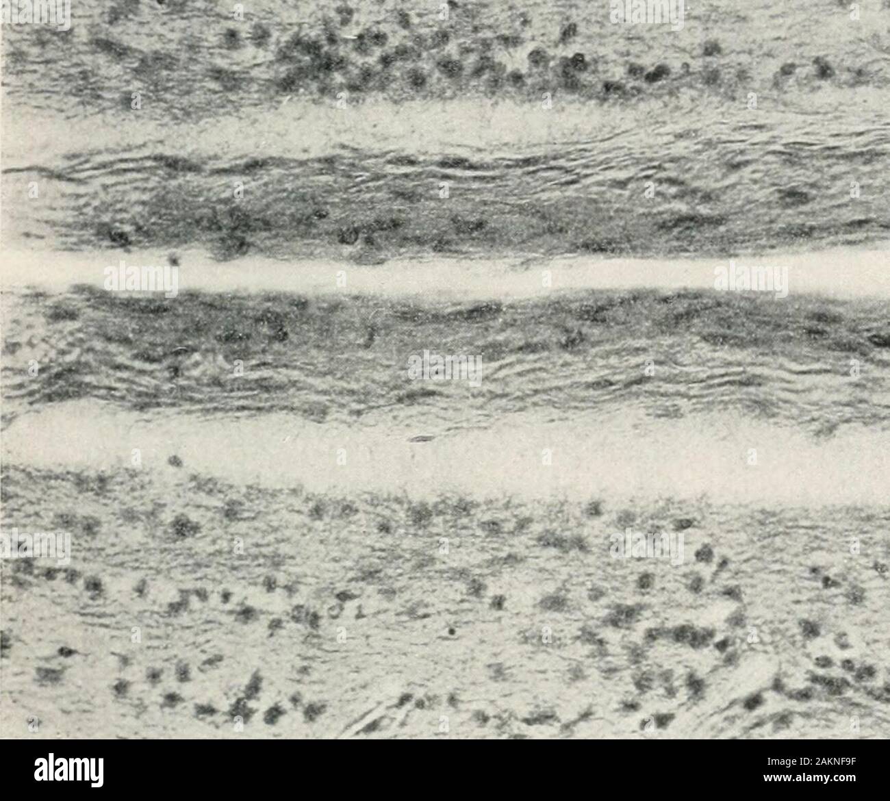 Reticular connective tissue hi-res stock photography and images - Alamy