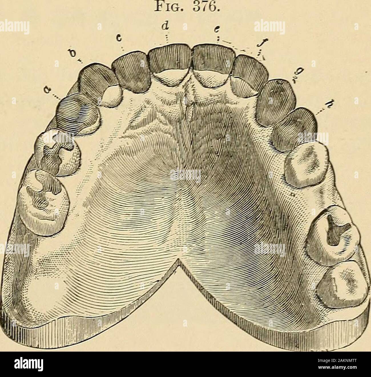 Gold filling teeth hires stock photography and images Alamy