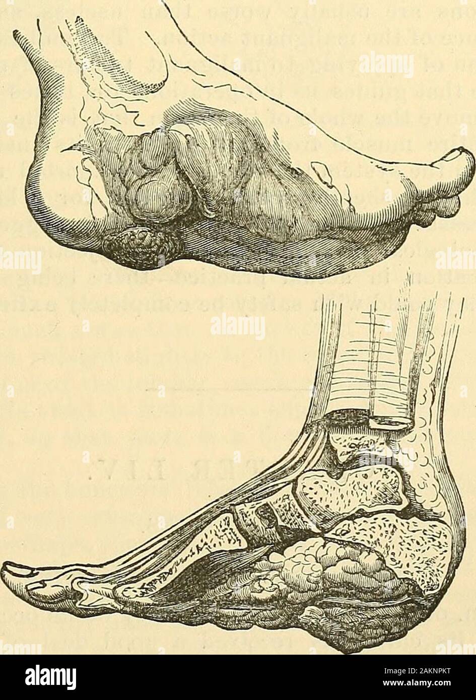 sartorius injuries