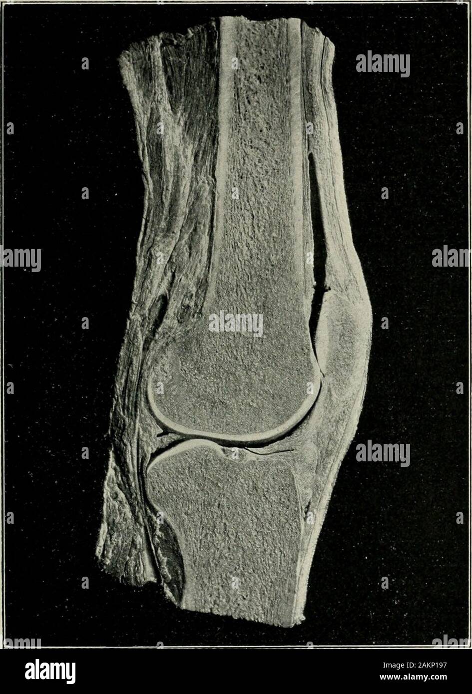 Thin shaft-rings from cattle-size tibia and metatarsus diaphyses.