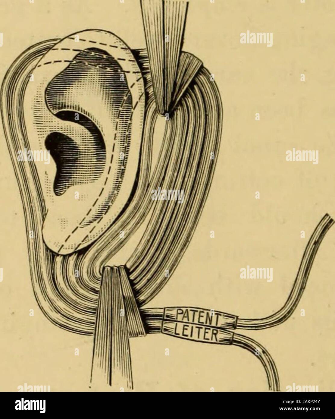 A treatise on the diseases of the ear including the anatomy and