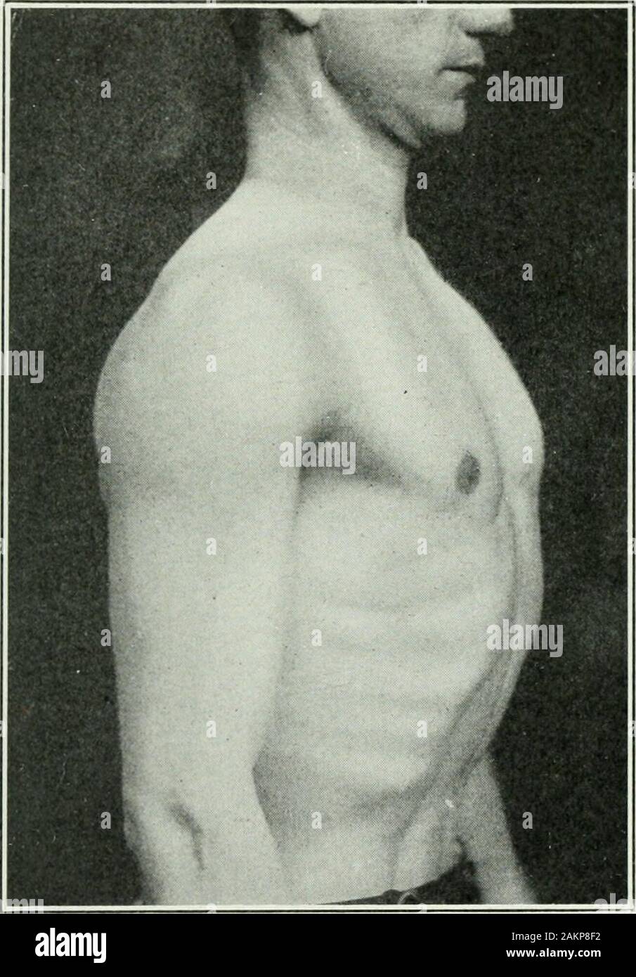 Feable Chest Applied anatomy and kinesiology; the mechanism of muscular movement ...