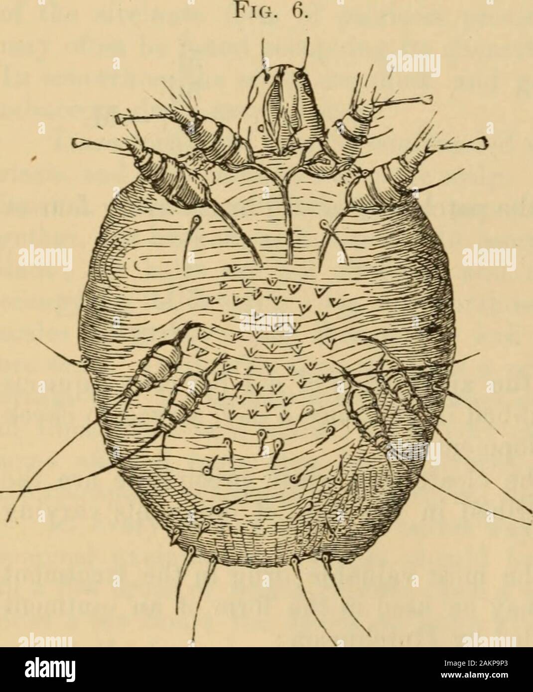 Scabies lesions hires stock photography and images Alamy