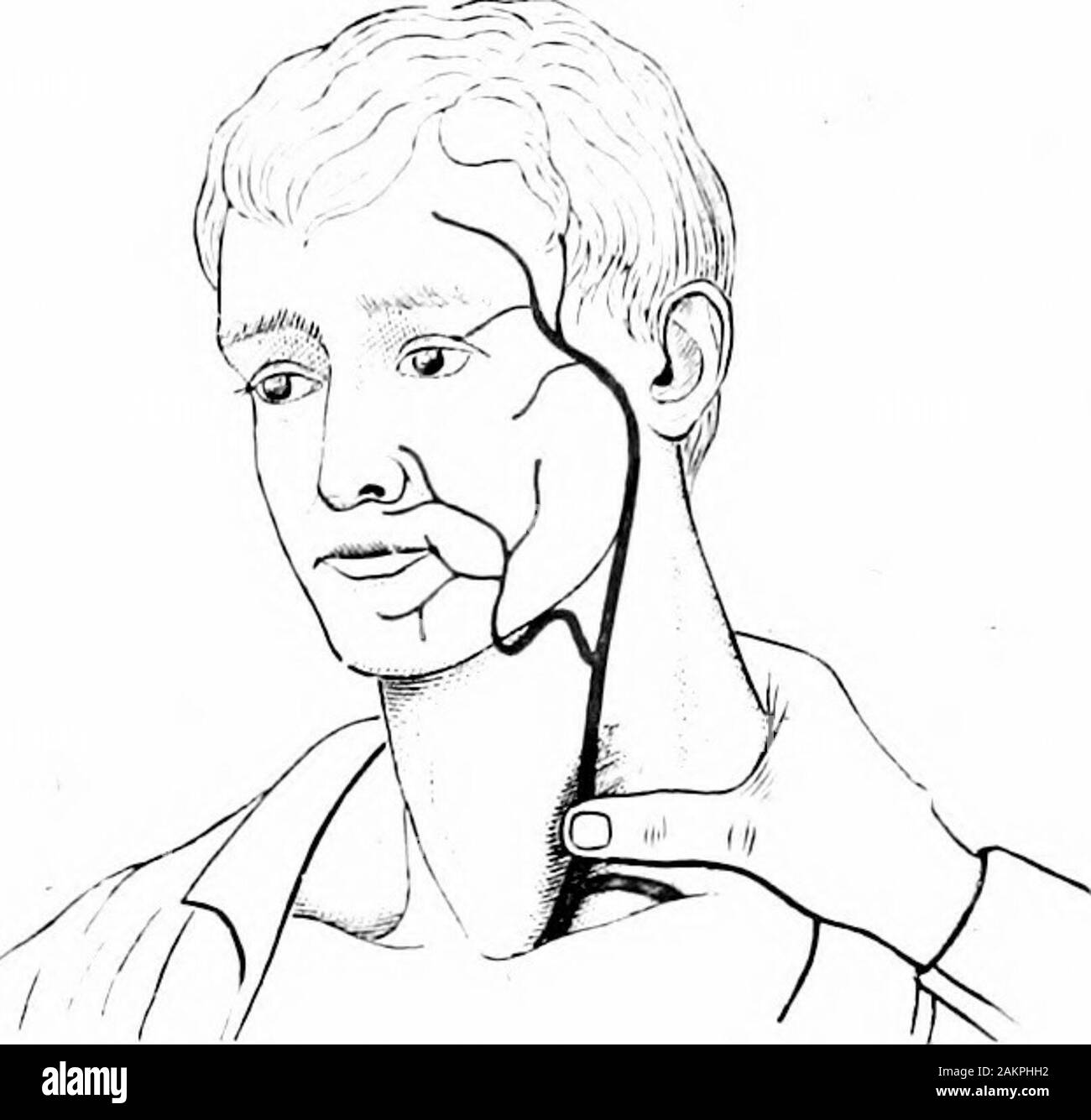 Dry blood spot Black and White Stock Photos & Images Alamy