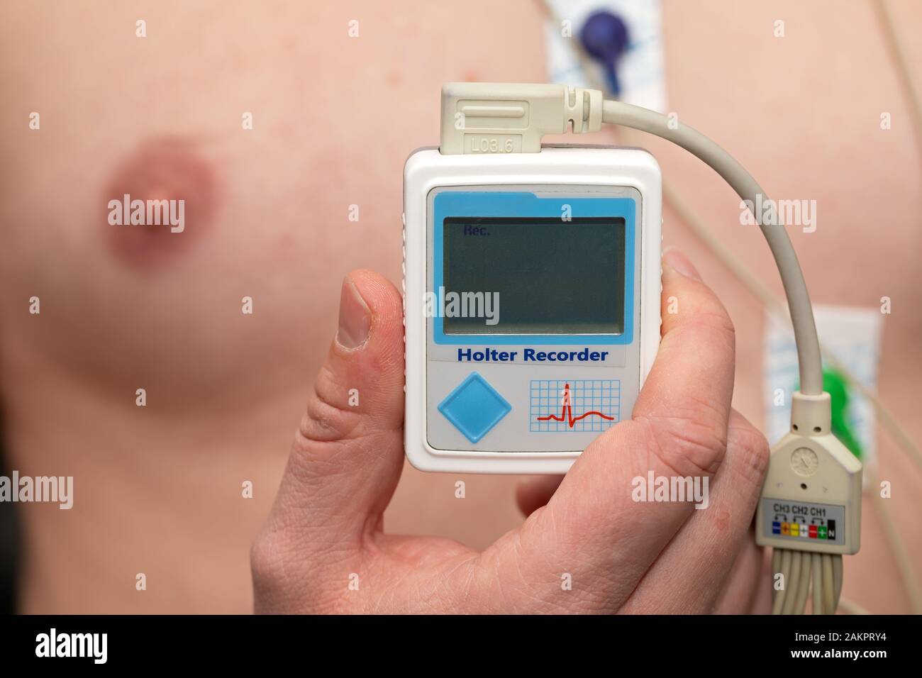 Young man with  heart diseases wearing holter monitor device for an electrocardiogram Stock Photo