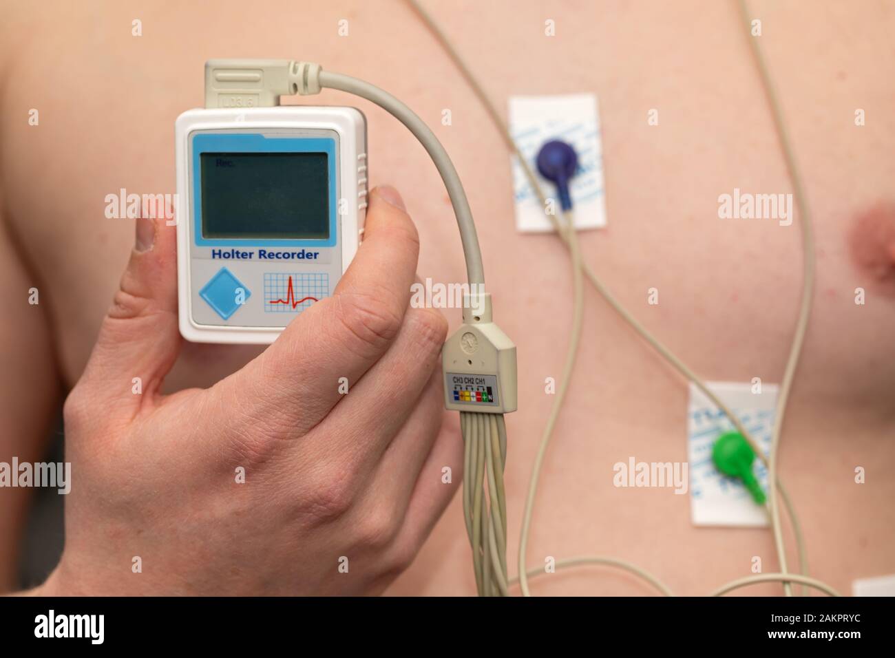 Young man with  heart diseases wearing holter monitor device for an electrocardiogram Stock Photo