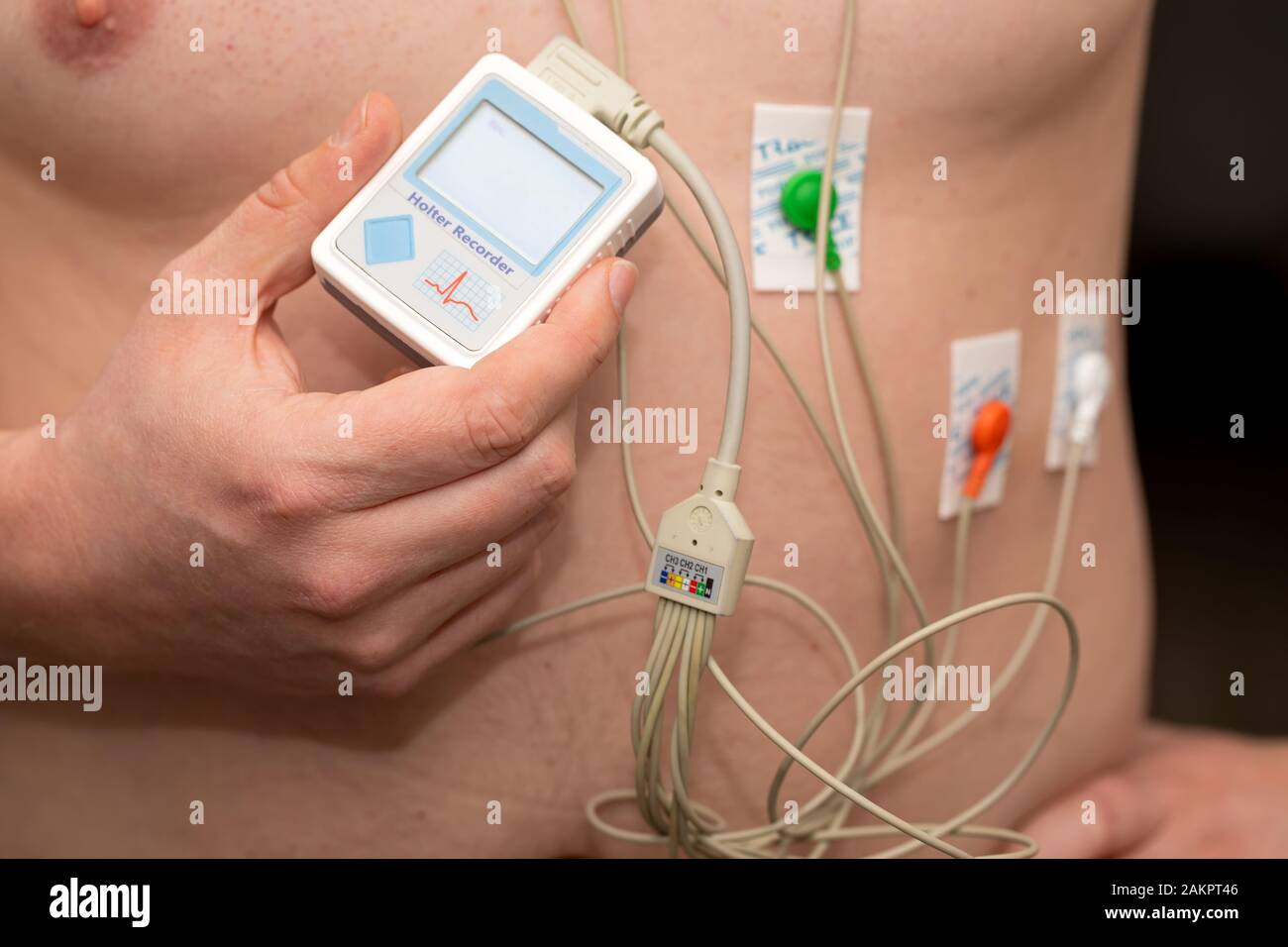 Young man with  heart diseases wearing holter monitor device for an electrocardiogram Stock Photo