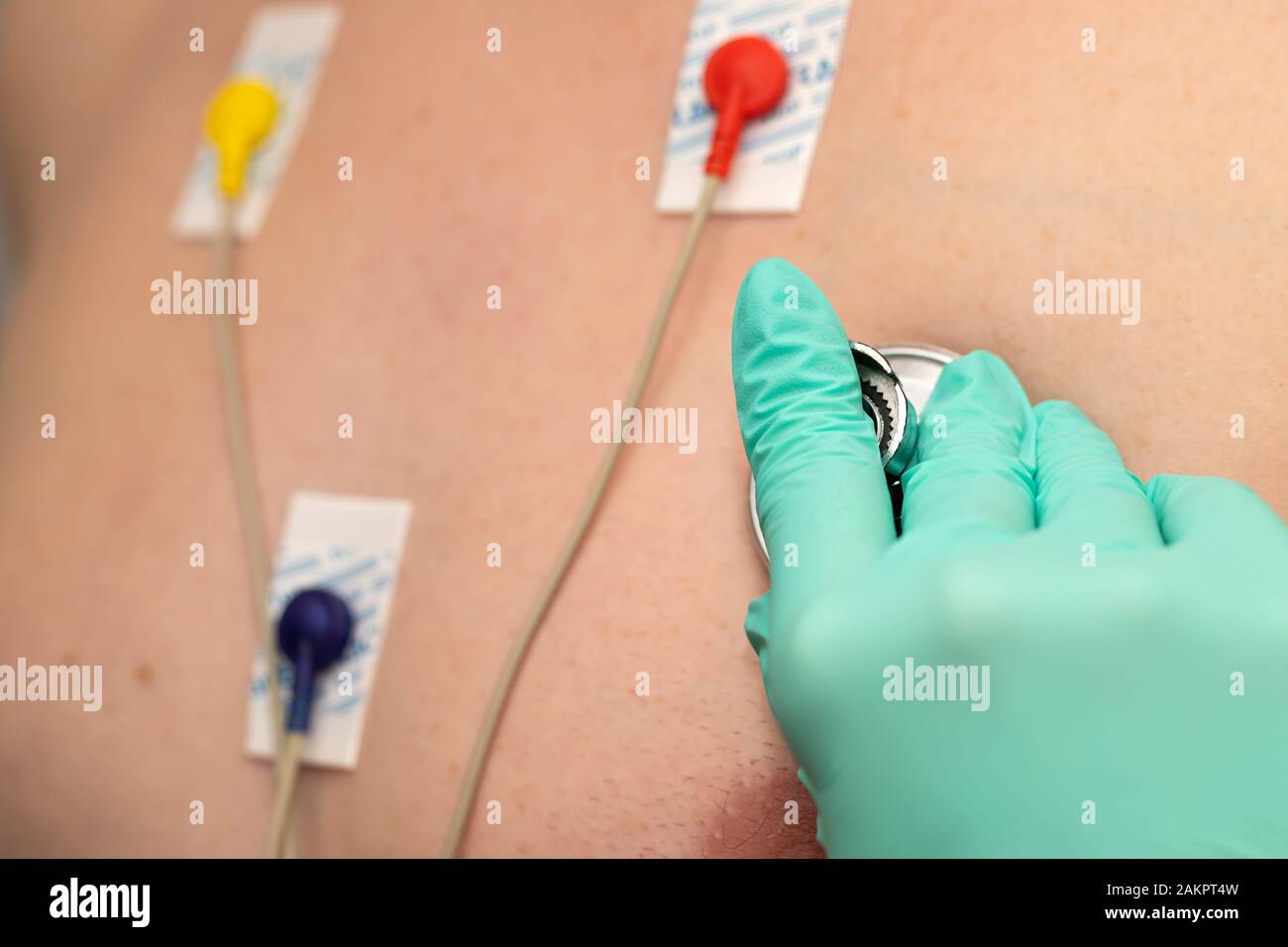 Young man with  heart diseases wearing holter monitor device for an electrocardiogram Stock Photo