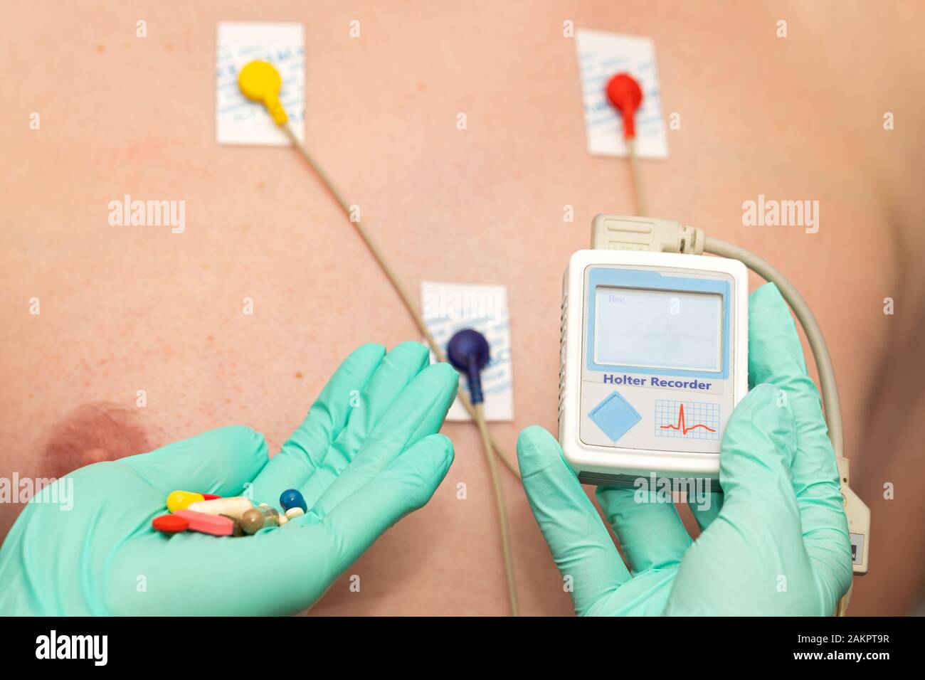 Doctor's hand applying holter heart monitor on young man's chest Stock Photo