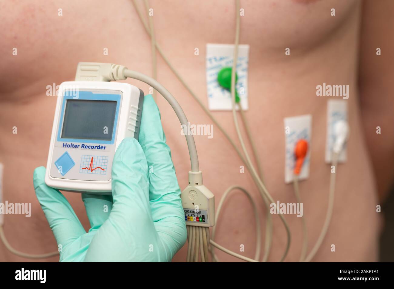 Doctor's hand applying holter heart monitor on young man's chest Stock Photo