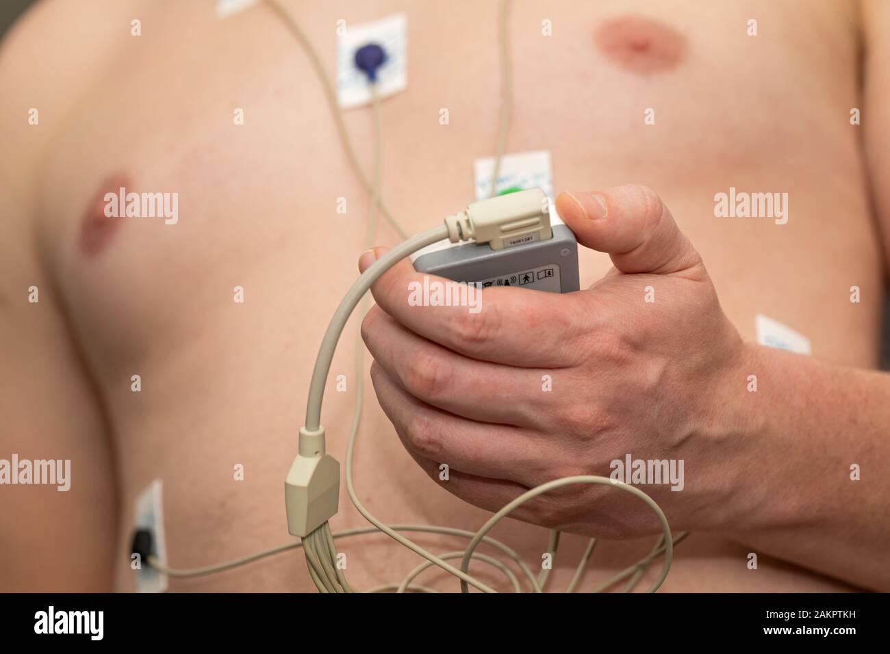 Young man with  heart diseases wearing holter monitor device for an electrocardiogram Stock Photo
