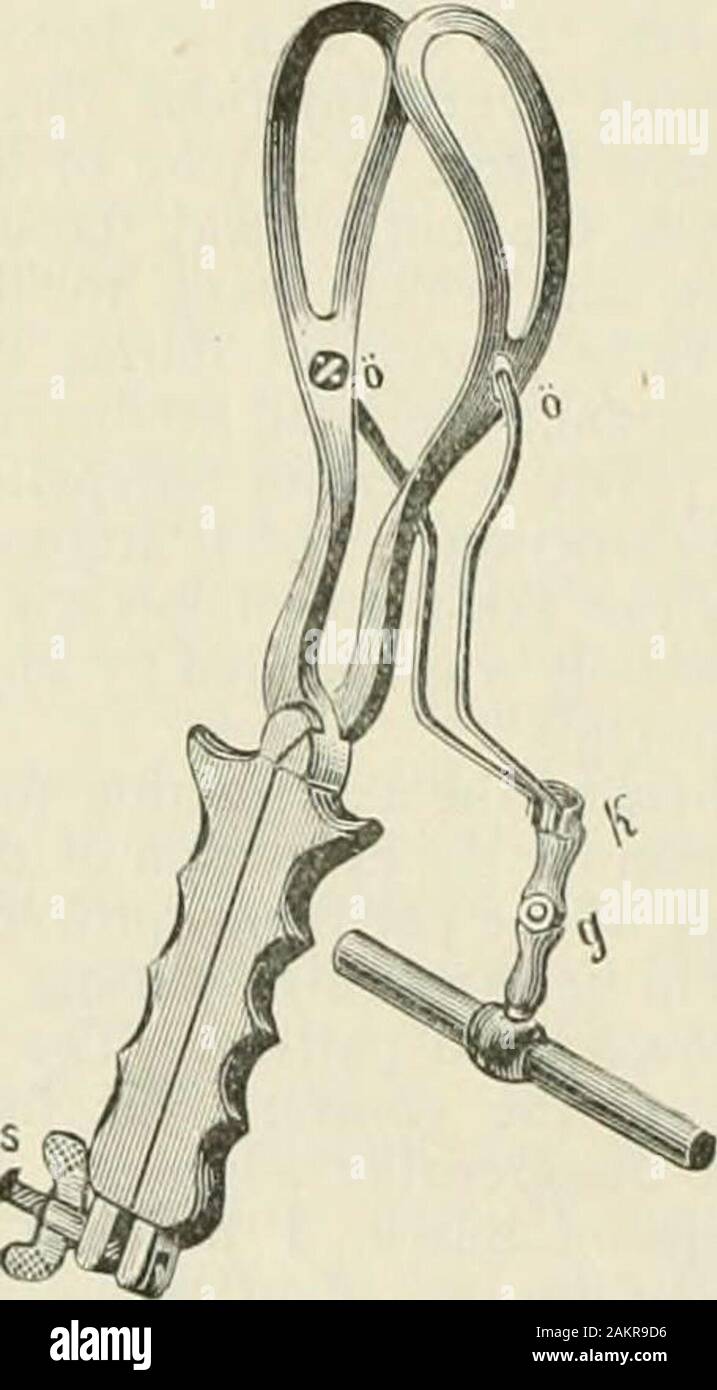 Journal - American Medical Association . this first pattern still Also the curvature of the traction-rods is unnecessarily strong and couldbe (latter as in Sangers forceps. The joint of the 1 1 .1 u 1 foeplitz u. Deui iao EXPERIENCES WITH THE AXIS-TRACTION FORCEPS. [Fkbruary 6, traction-rods consists of two metal grooves, in whichthe two button-shaped ends of the traction-rods areattached. This really very simple manner of form-ing the traction-rods I should like to have changedin another pattern, perhaps by the contrivance ofTarnier, as it is brought in use again by Dr. Neale.Certainly this g Stock Photo