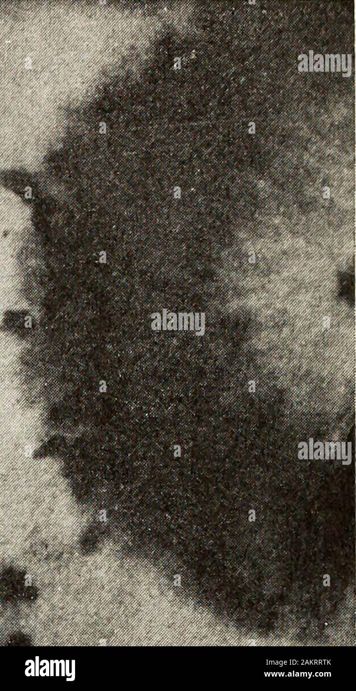 Annual report of the North Carolina Agricultural Experiment Station . Fig. 13.— Ascochyta Chrvsanthenfi Stevens; portion of colony showing few pycnidia; cf.Fig. 14. Stock Photo