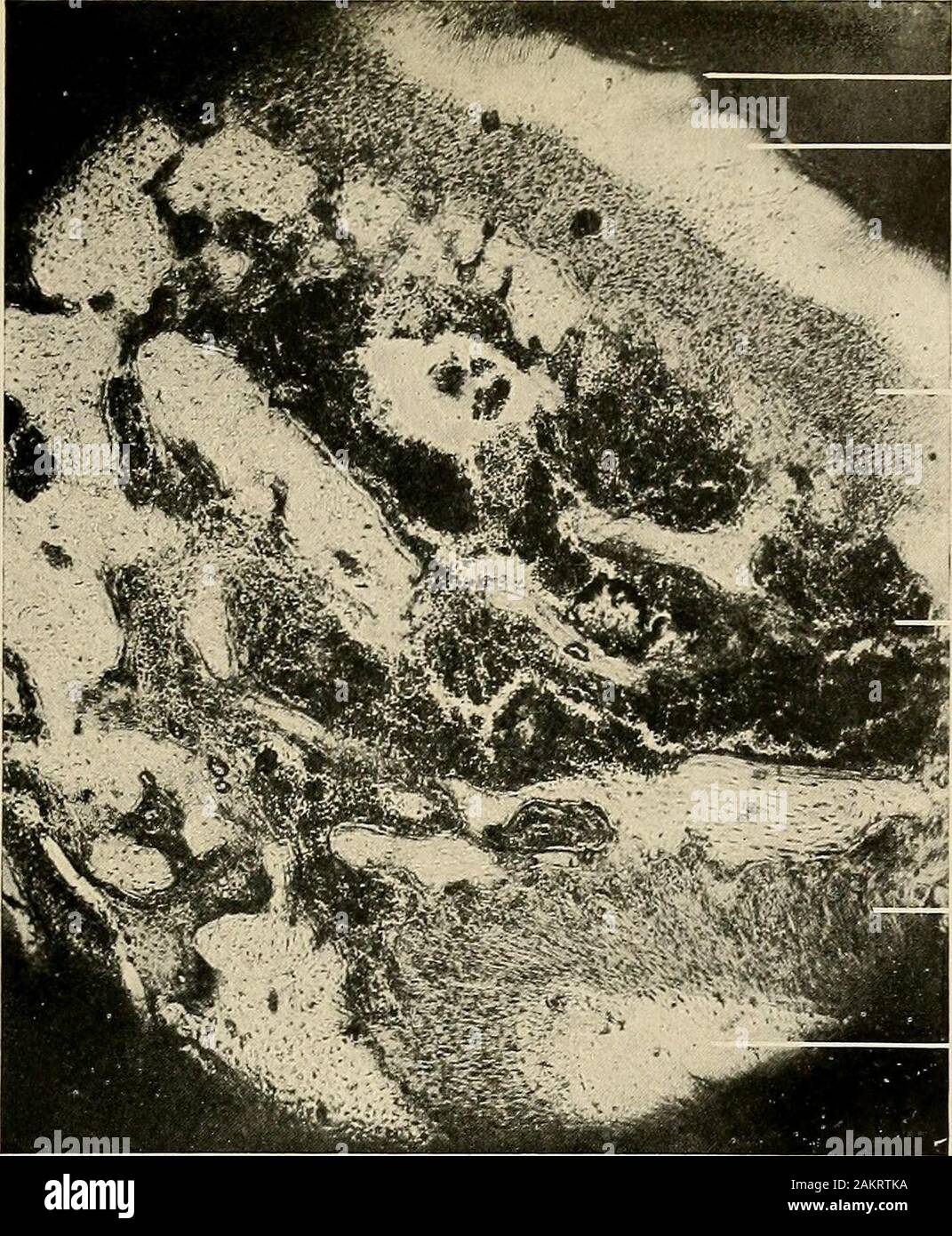 Principles and practice of operative dentistry . Fig. 200.—Section of peridental membrane, showing epithelial bodies or glandular structures. (F. B. Noyes.)X 900. -D, dentin; C, cementum; C&, cementoblasts; E, epithelial bodies ; F, white fibres.. Mucous membrane GUBl Periosteum Alveolar process Pericementum Cementum Fig. 201.—Transverse section of the jaw through the mucous membrane, gum, and alveolar process. (V. A. Latham.) X 60. Mucous membrane and epithelium Stock Photo