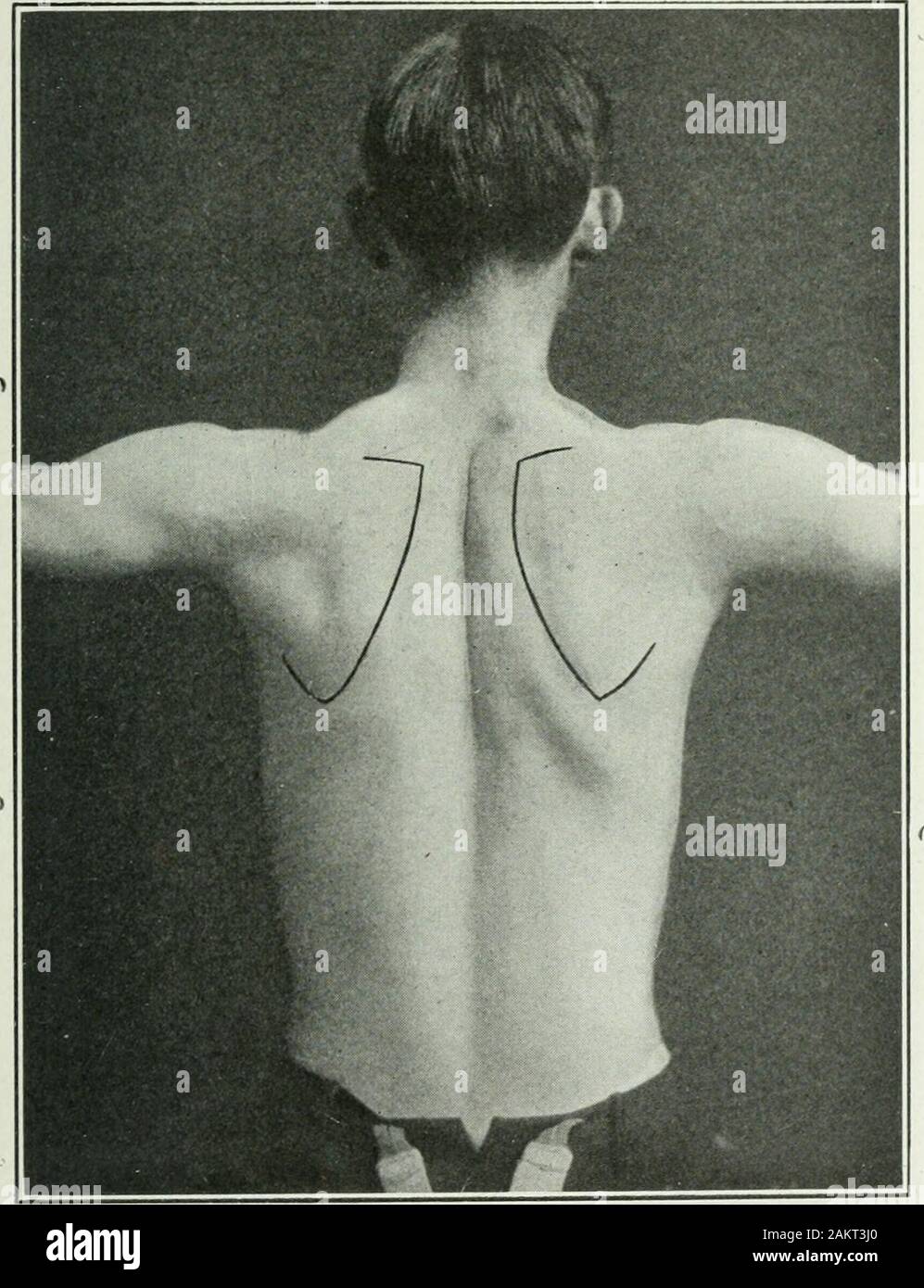 Applied anatomy and kinesiology; the mechanism of muscular movement
