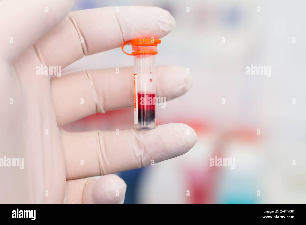 Edta blood hires stock photography and images Alamy