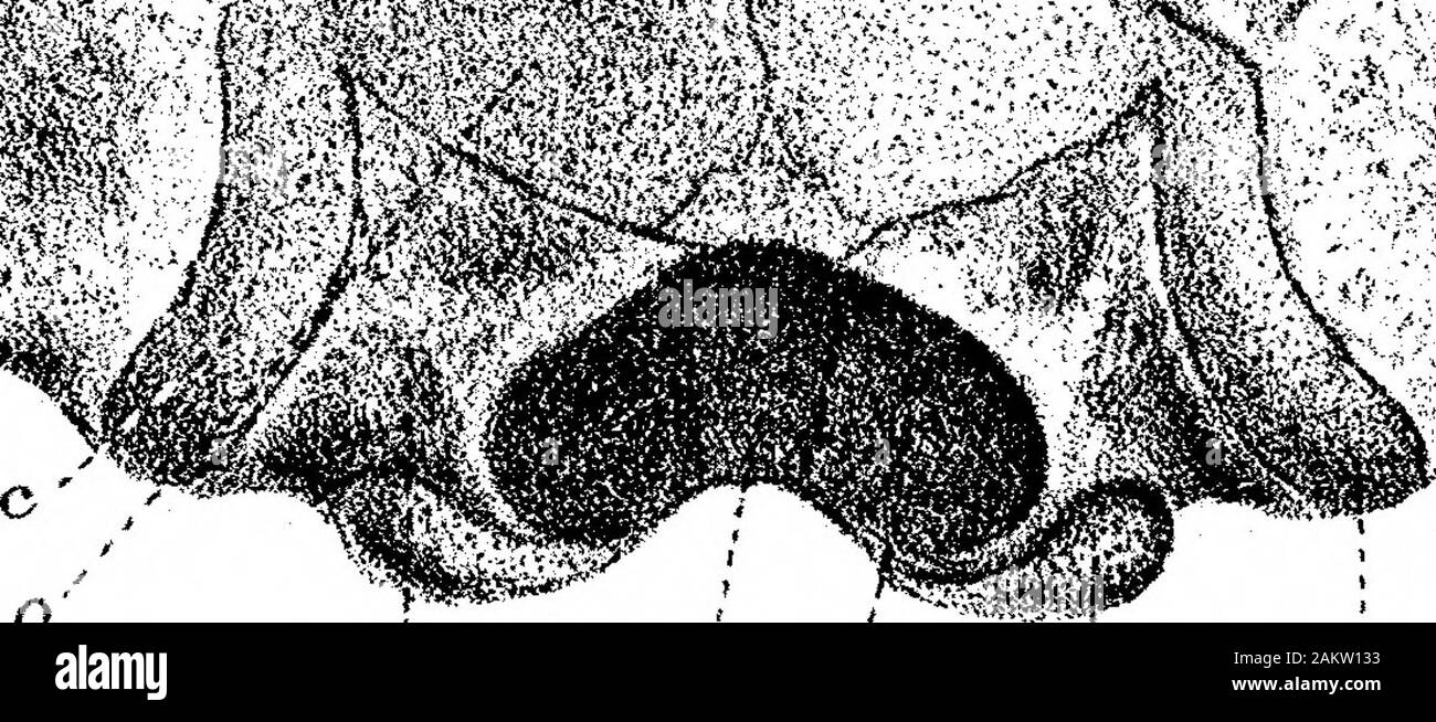 On the Structure and Development of the Skull in the BatrachiaPart II