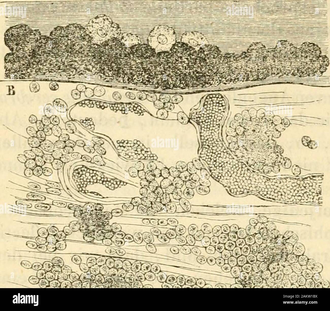 Handbuch der gesammten Augenheilkunde . nach dem Eindringenfremder