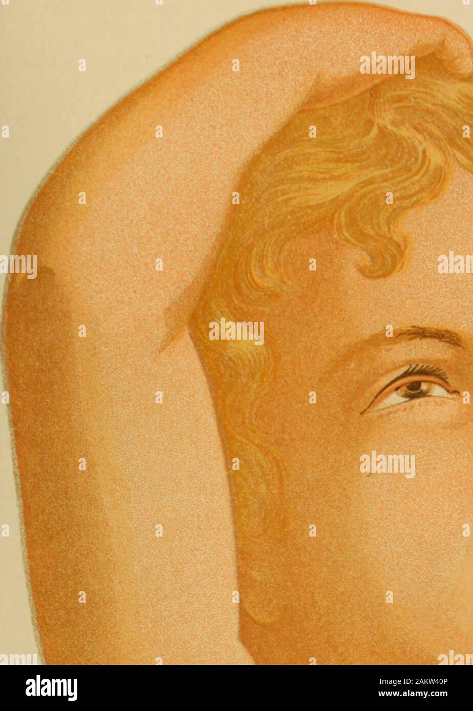 Flushed skin hires stock photography and images Alamy