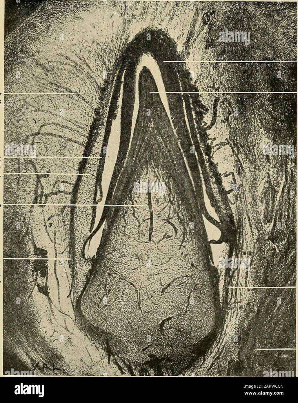 Stella Reticulum Principles and practice of operative dentistry . Stellate reticulum ...