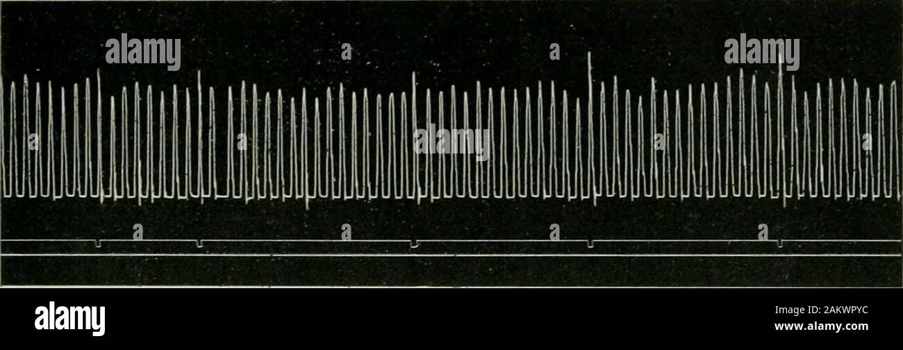 American journal of physiology . e induction shock. It was found that a sensory stimulus applied just as the muscle wasbeginning to contract, caused an increase in the height of the con-traction (Fig. 3). At this point in the research Hofbauer ^ published experimentssimilar to my own. He used sound as the reinforcing stimulus and 1 For a full account of the double lever see Czermak, J. H. : Der electrischeDoppelhebel, Leipzig, 1871. 2 The contact screws of Czermaks lever were here reversed, the lower one (c)being the conductor; the previous description applies to the arrangement in theexperime Stock Photo
