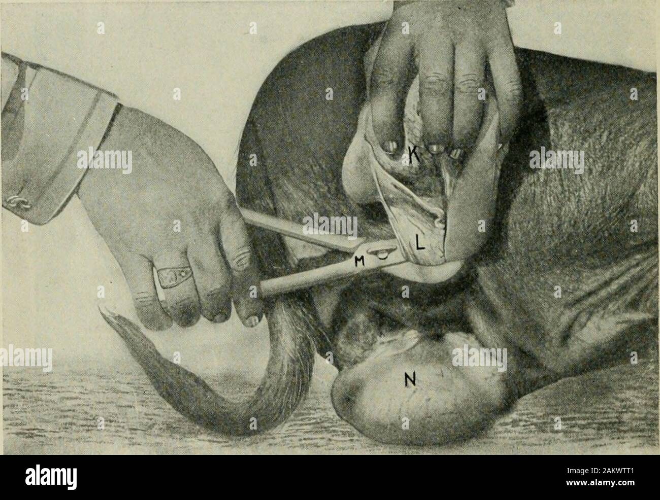 This consists in placing a rail or bar over the neck of the... 