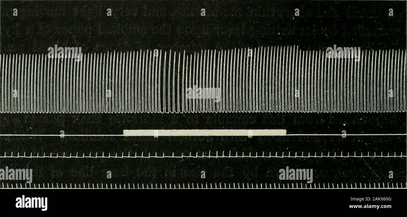 American journal of physiology . ane manometer. The secondcurve was written by the armature of an electro-magnet placed in theprimary circuit of a du Bois-Reymond inductorium. The heavywhite line records the stimulation of the peripheral end of the vagusnerve with a weak induced current; the individual strokes of thearmature are blended, owing to the slow speed of the smoked paper.The third curve marks the number of drops of blood flowing throughthe coronary vessels, the recording apparatus being that used forthe experiment illustrated by Fig. 4. The fourth curve marks thetime in seconds. The Stock Photo