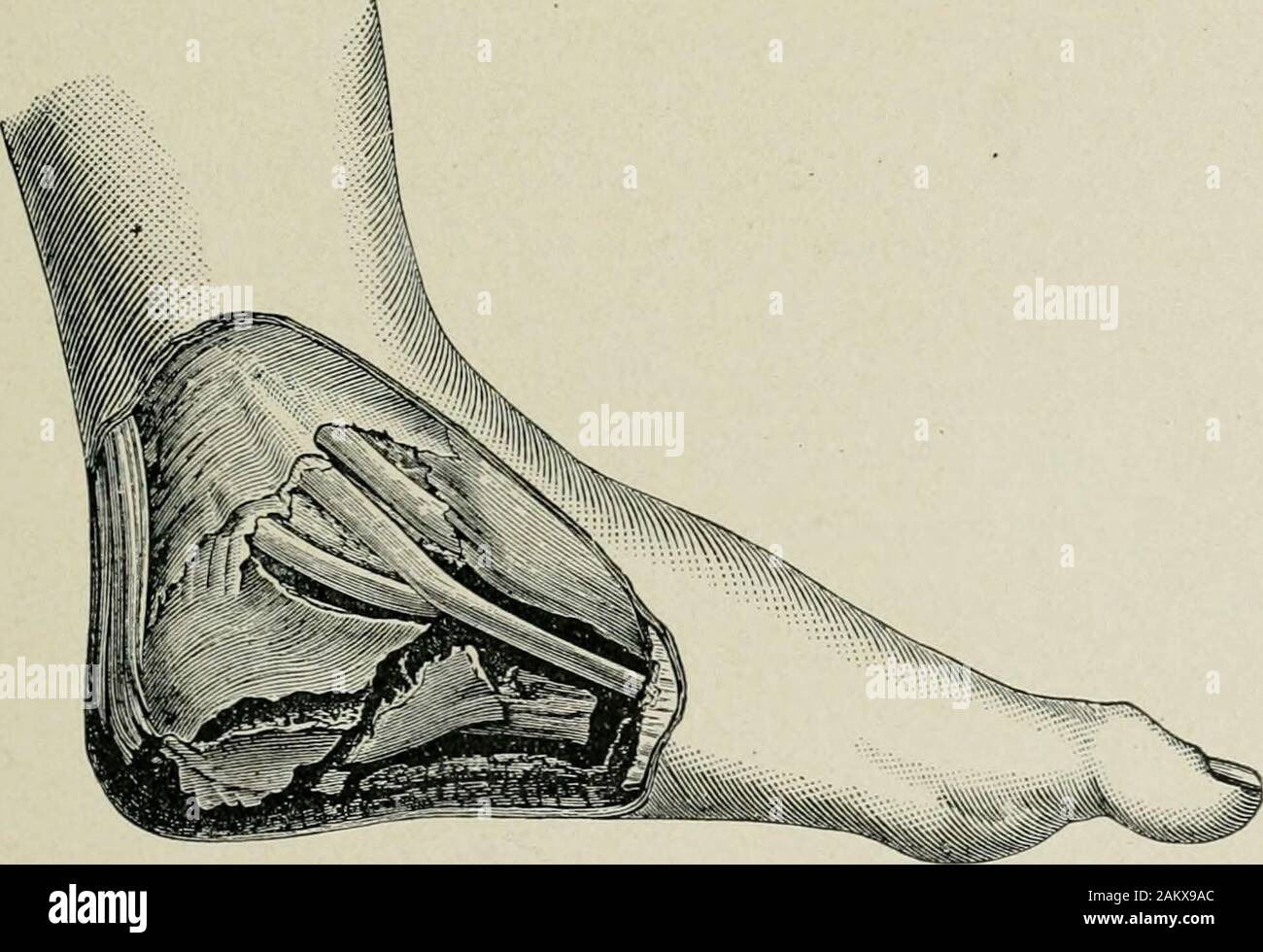 American practice of surgery : a complete system of the science and art ...