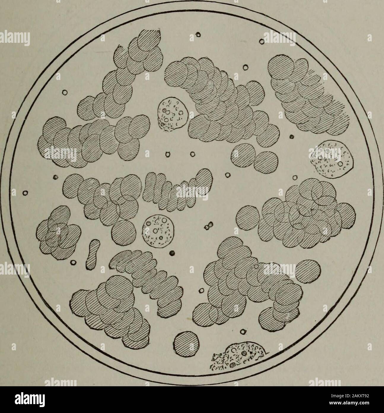 Syphilis Microbe Notes Syphilis Microscopic Diagram