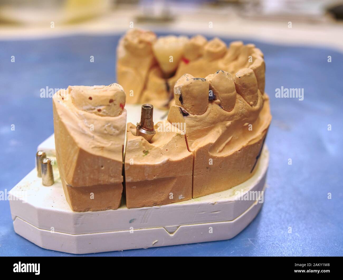 Technical shots on a dental laboratory. Dentist work on a dental