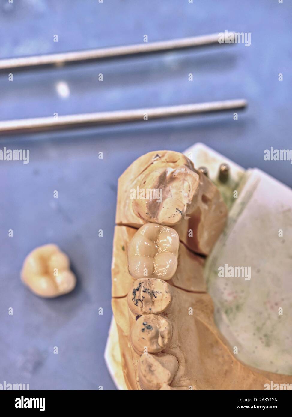 Plaster cast of human jaws. Dental casting gypsum model jaws in