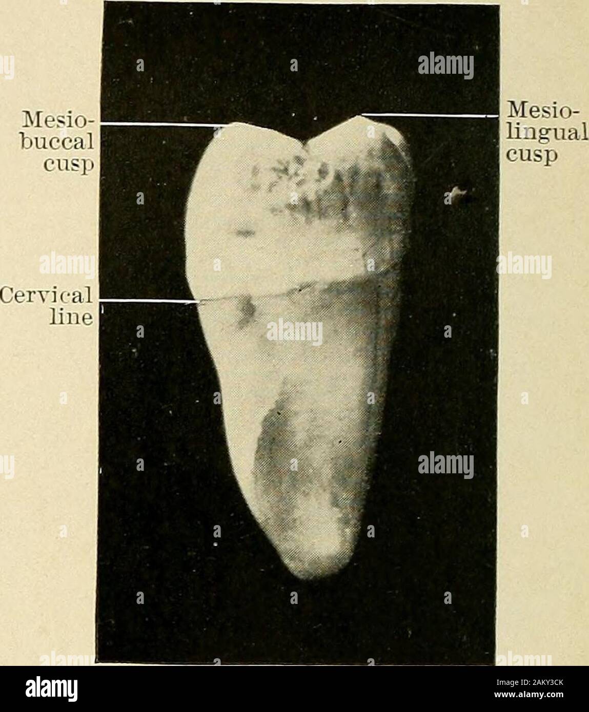 Principles and practice of operative dentistry . Fig. 69.—Inferior right first molar, iingual surface.(Enlarged.) Fig. 70.—Inferior right first molar, mesial surface.(Enlarged.) Median-Buccal groove buccal cusp Disto-buccal groove Stock Photo