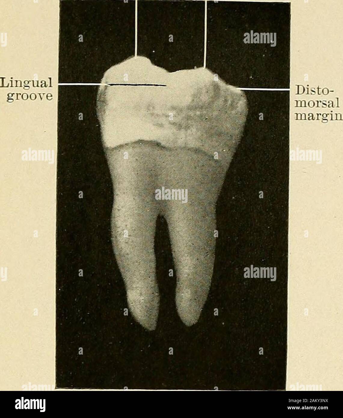 Principles and practice of operative dentistry . Fig. 6S.—Inferior