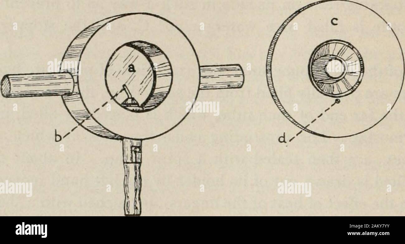 Hemorrhagic jaundice hires stock photography and images Alamy