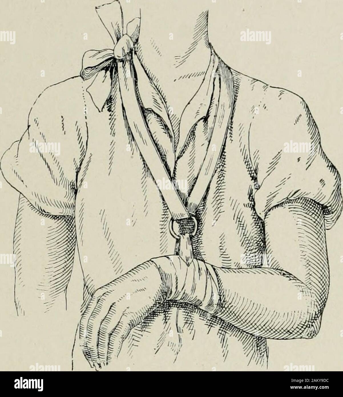 American practice of surgery : a complete system of the science and art of  surgery . fdeformity. Hamilton claimed that the action of the flexor carpi  radialis and thepronator quadratus, and the