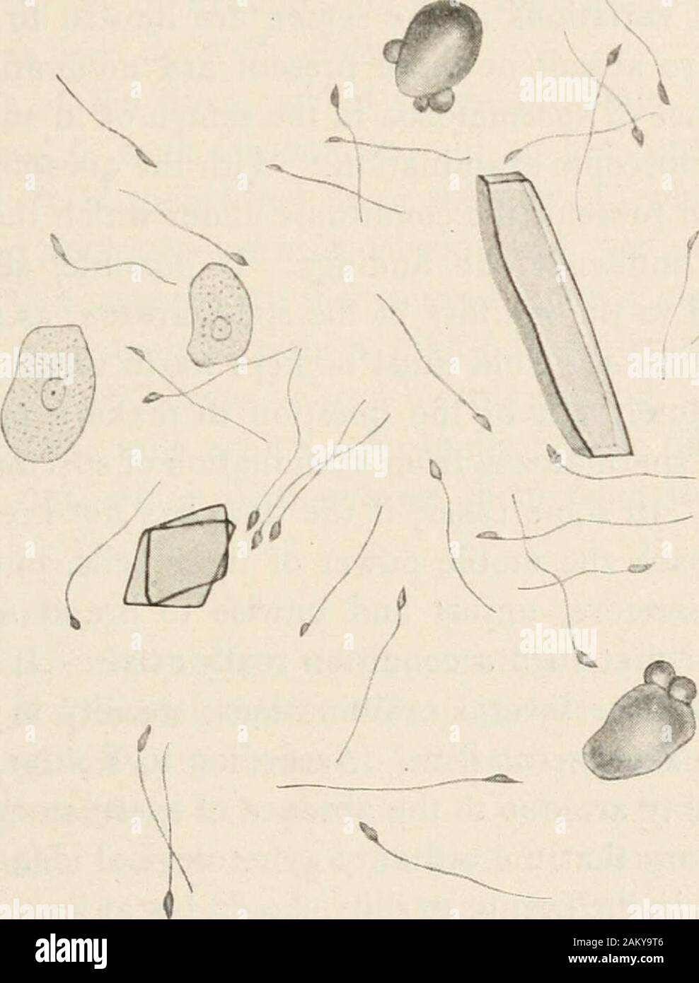 Diagnostic methods, chemical, bacteriological and microscopical, a text-book for students and practitioners . h, and 2 in thickness. Just behind 1 See Steudel, Ztschr. f. physiol. Chem., 1913, LXXXIII, 72. * Koessler (Trans. Chic. Path. Soc, 1912, VIII, 280) has shown that the spermatozoa mayact as direct carriers of infectious agents, among these being the spirochaeta pallida. 376 SECRETIONS OF THE GENITAL ORGANS. 377 this pyriform head is a short cylindrical portion measuring 6 microns in length,which is known as the middle piece. This tapers somewhat to the point ofunion with the tail. This Stock Photo