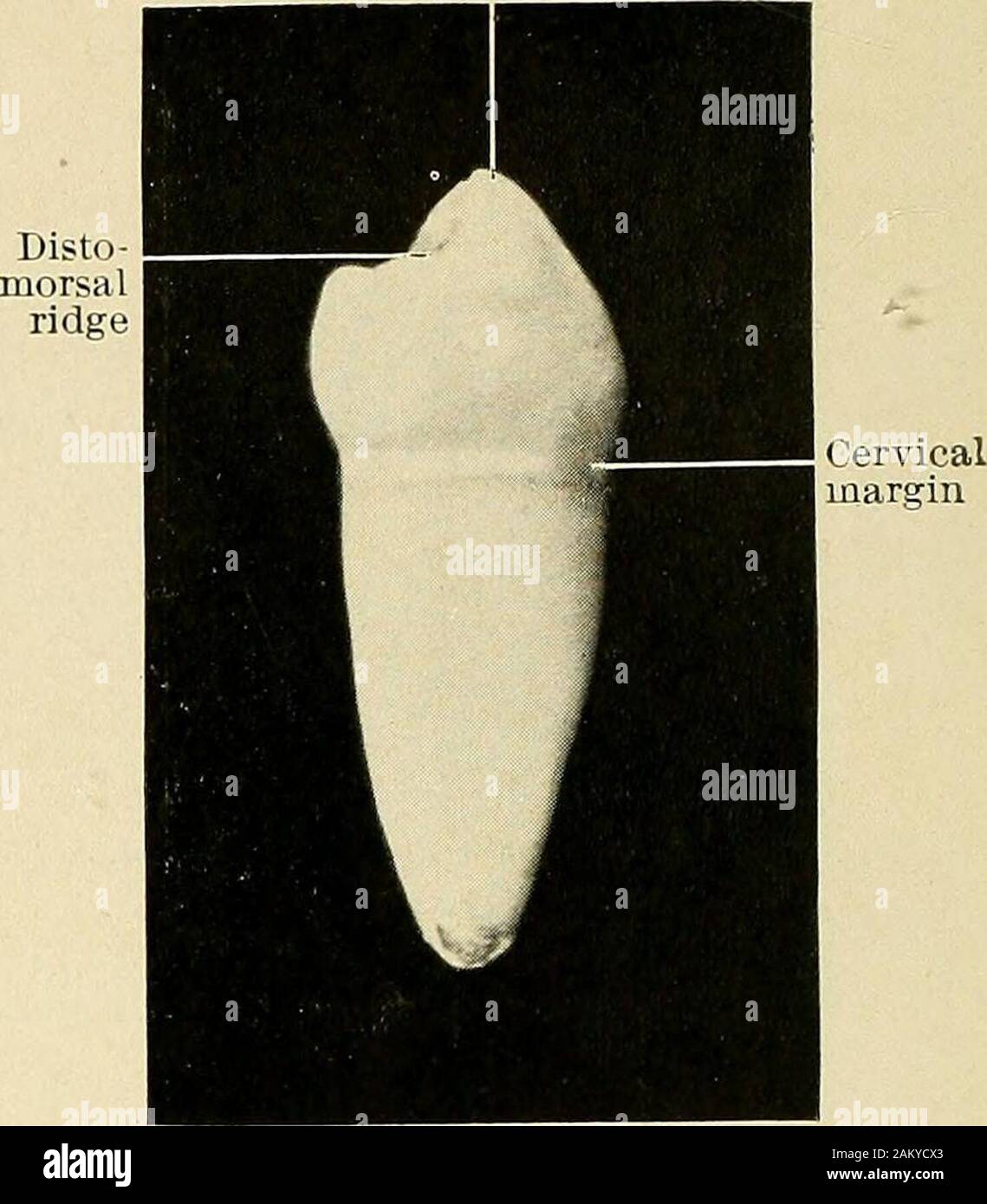 Principles and practice of operative dentistry . Fig. 45.—Inferior