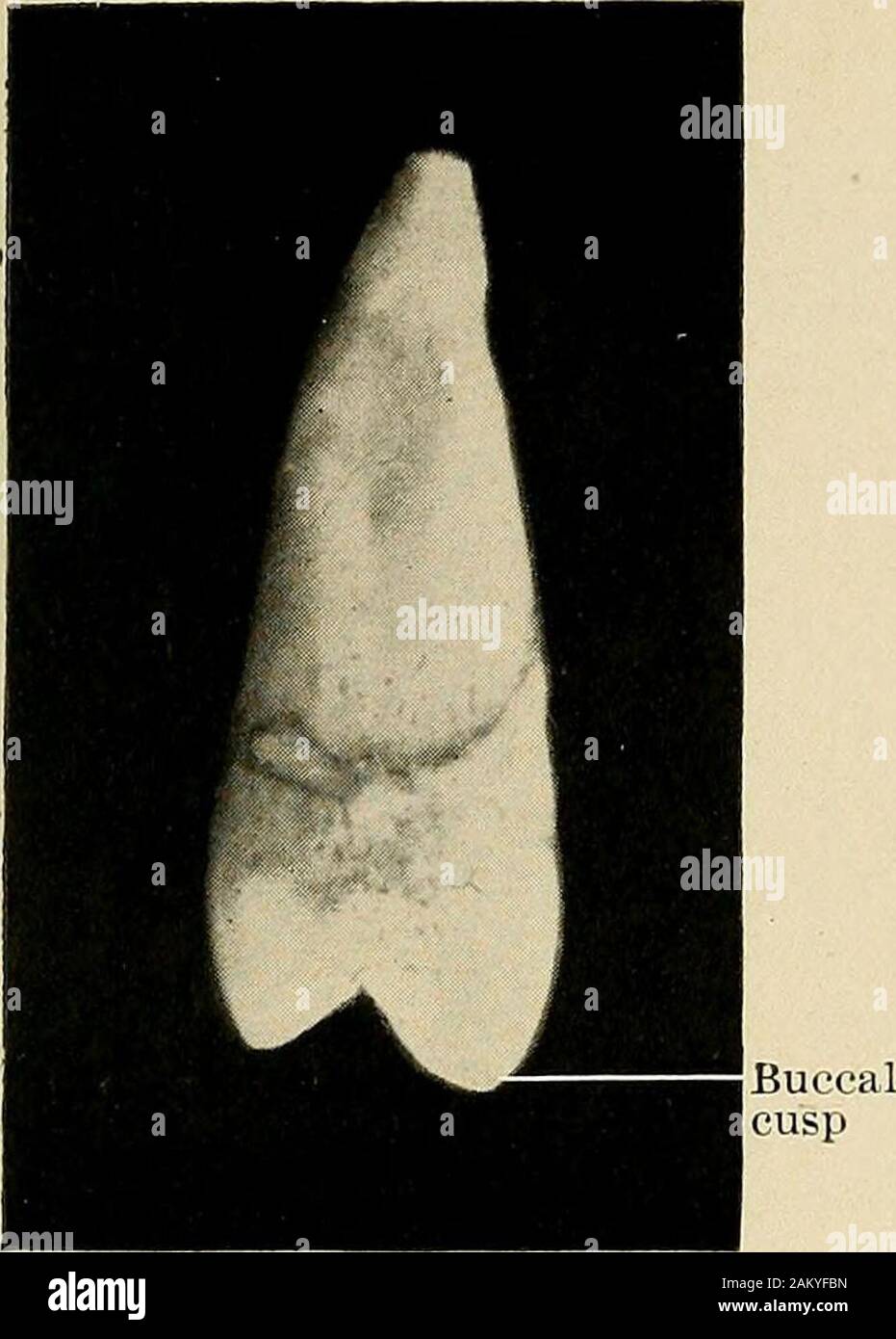 Buccal Tooth Surface
