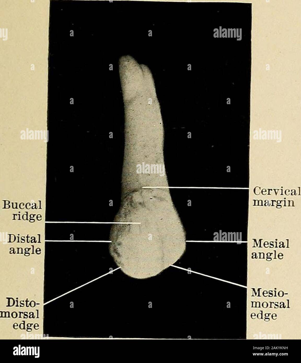 Occlusal surface hires stock photography and images Alamy
