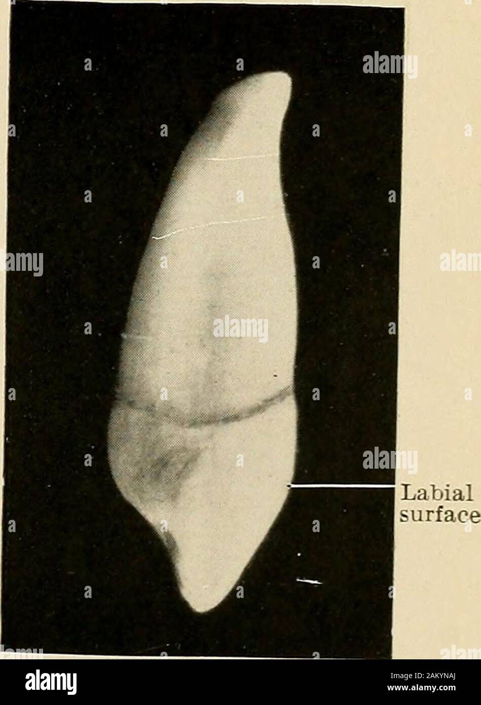 Principles and practice of operative dentistry . Pig. 27.—Superior