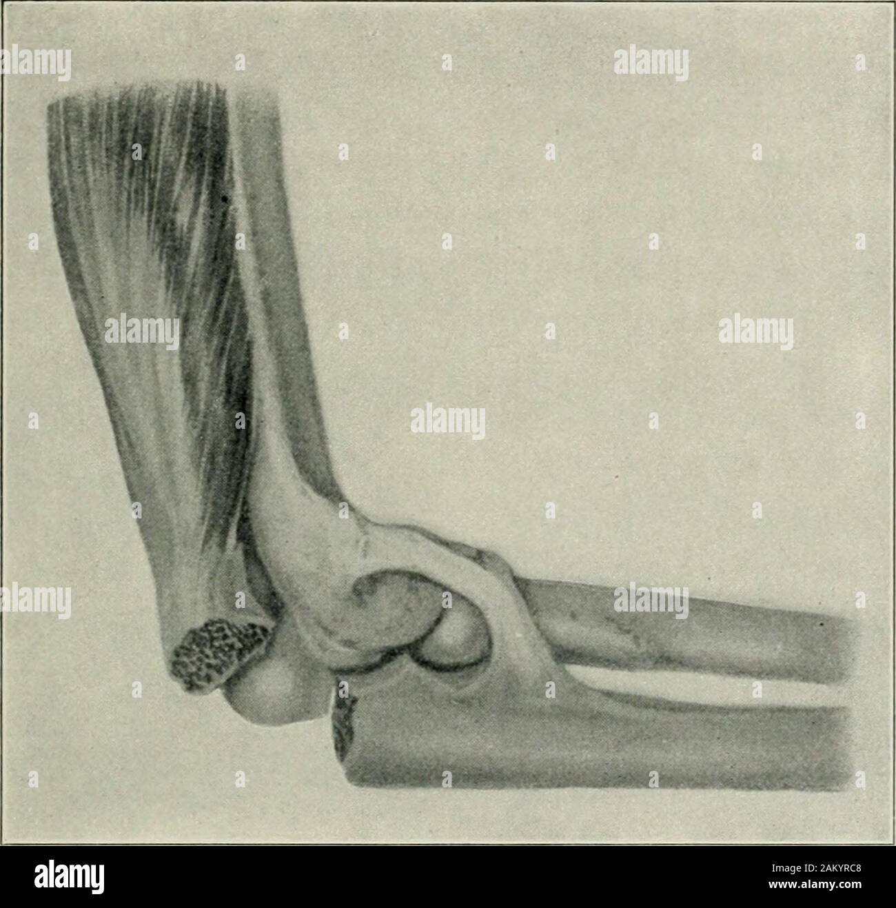 American practice of surgery a complete system of the science and art