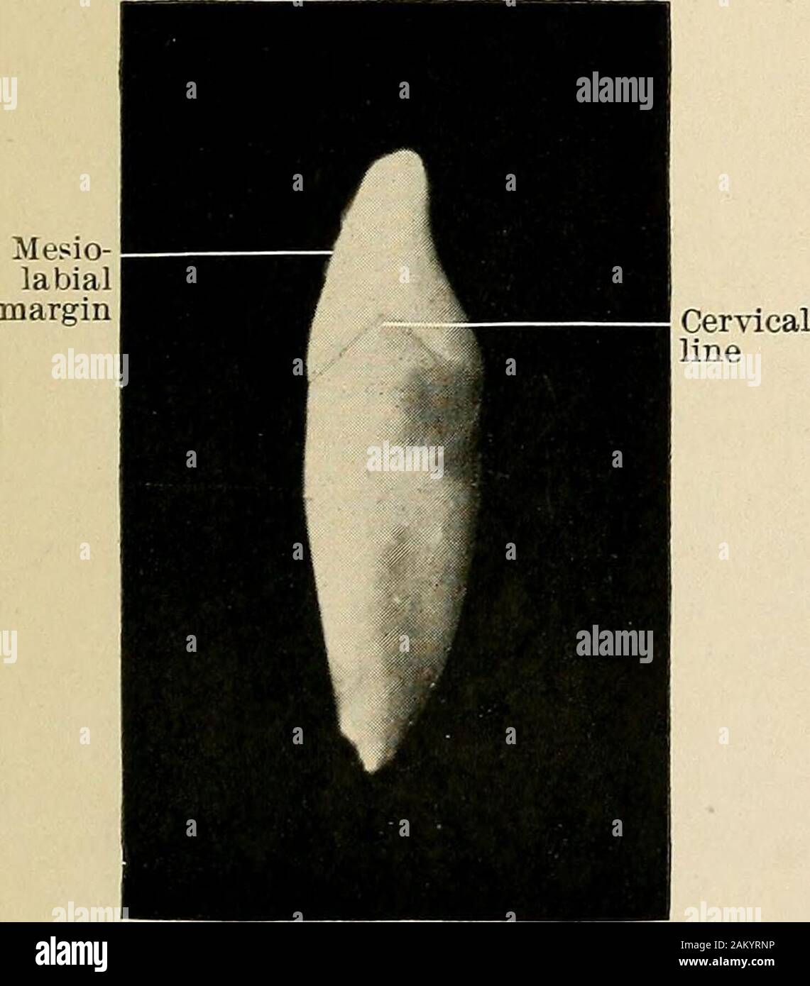Principles and practice of operative dentistry . Fig. 17. Inferior