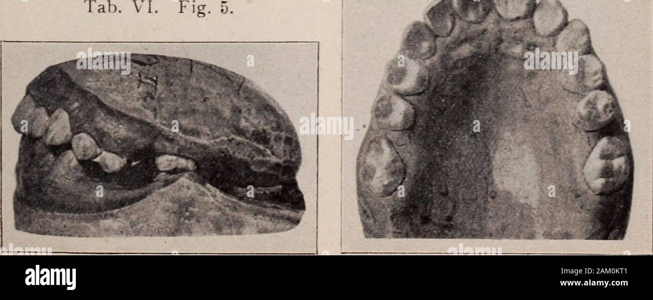 Talb Vi Dental review; devoted to the advancement of dentistry. . III.Tab. VI ...