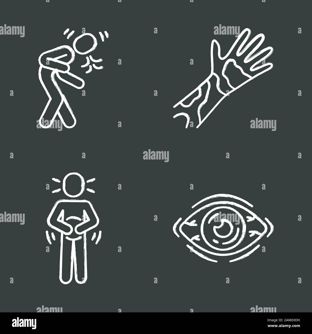 Seasonal allergy symptoms chalk icons set. Contact dermatitis