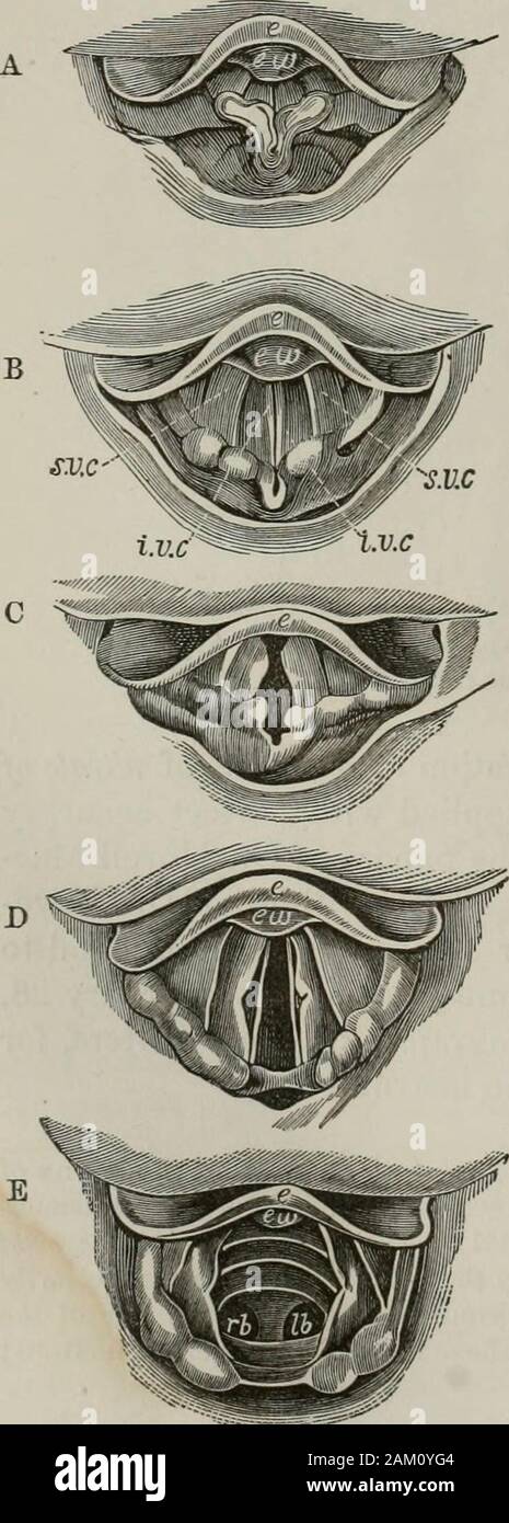 The science and practice of medicine . nt the arrangement of the internal parts of the larynx ofDr. Czermak, after drawings made by Dr. Elfinger, of Vienna, from images demon-strated in the laryngoscope {New Syden. Soc, 18G1). The parts situated to the rightof the middle line of these figures, obtained by the aid of a mirror, are necessarilyreversed from their natural position, and correspond to those on the left side of thelarynx, and vice versd. That which is situated above in the drawing exists in front;that which is below is situated posteriorly. SPECIAL PATHOLOGY—INFLAMMATION OF THE MOUTH Stock Photo