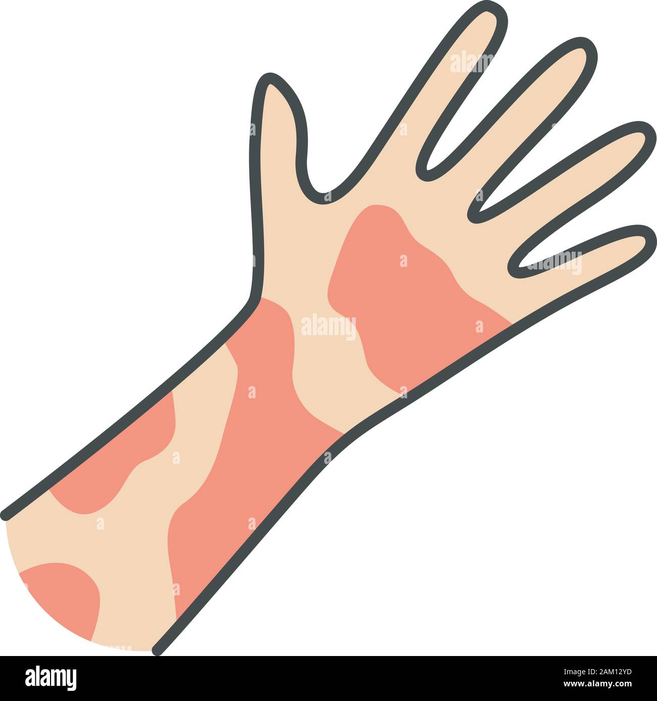 Contact dermatitis, hives color icon. Skin redness, rash, irritation