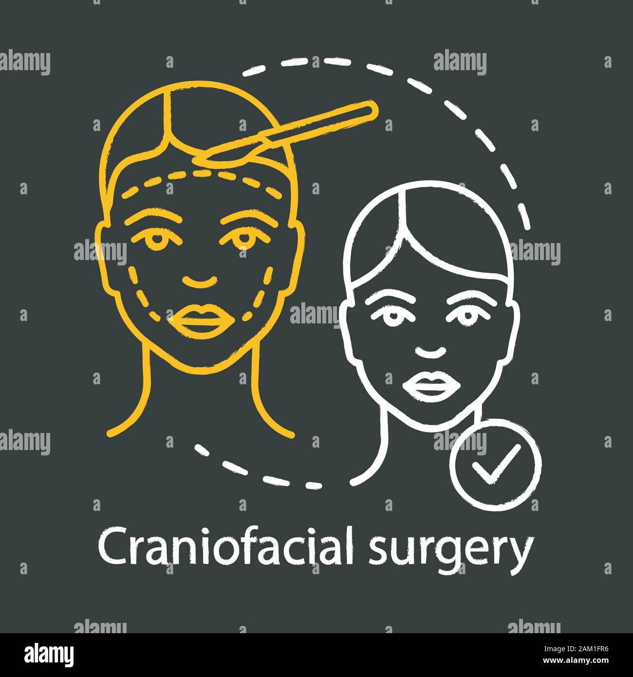 Craniofacial surgery chalk icon. Head, face, neck deformities. Plastic