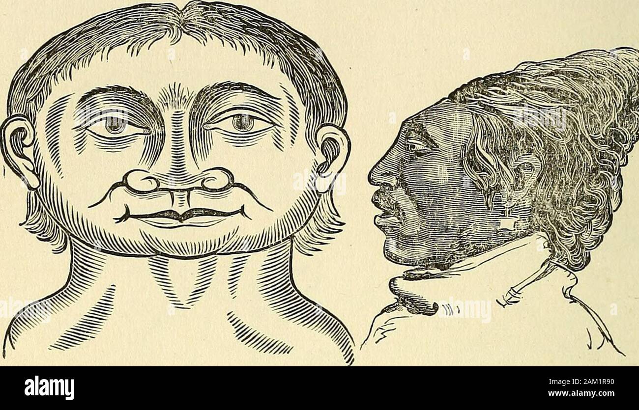 Nature's revelations of character; or, physiognomy illustratedA description of the mental, moral and volitive dispositions of mankind, as manifested in the human form and countenance . On the other hand, the people of Sigiunus, a city ofEgypt, take pains to secure a low and flat form of head, asin fig. 5. The low Dutch, the French, and the Portugueseincline to low and elongated heads, more or less flat on thetop. This last peculiarity is observable in the people ofBrazil also. Broad heads are the fashion with the Muscovites, as infig. 6. Their heads and faces are flattened artificially duringc Stock Photo