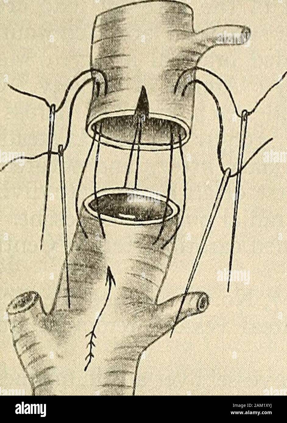 Transverse threads hi-res stock photography and images - Alamy