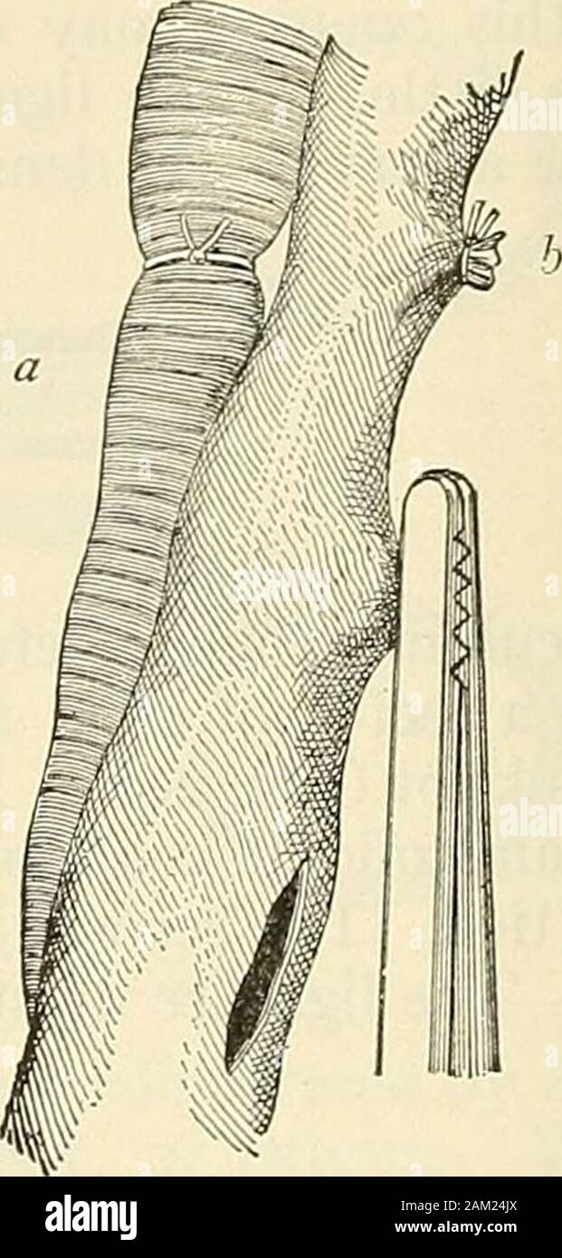 Modern surgery, general and operative . Fig. 2og.—^Hagedorns needles